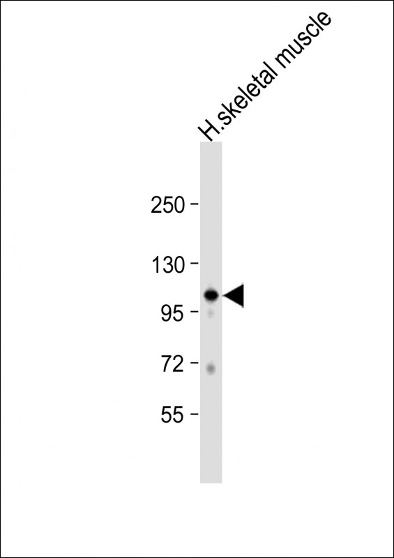 WB - GAS2L2 Antibody (C-term) AP11417b