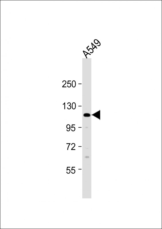 WB - ECT2L Antibody (C-term) AP11601b