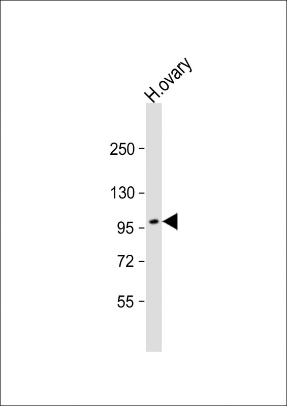 WB - ESPNL Antibody (C-term) AP12361b