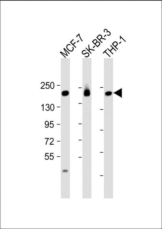 All lanes : Anti-PREX1 Antibody (C-term) at 1:2000 dilutionLane 1: MCF-7 whole cell lysateLane 2: SK-BR-3 whole cell lysateLane 3: THP-1 whole cell lysateLysates/proteins at 20 �g per lane.  SecondaryGoat Anti-Rabbit IgG,   (H+L),  Peroxidase conjugated at 1/10000 dilution.  Predicted band size : 186 kDaBlocking/Dilution buffer: 5% NFDM/TBST.