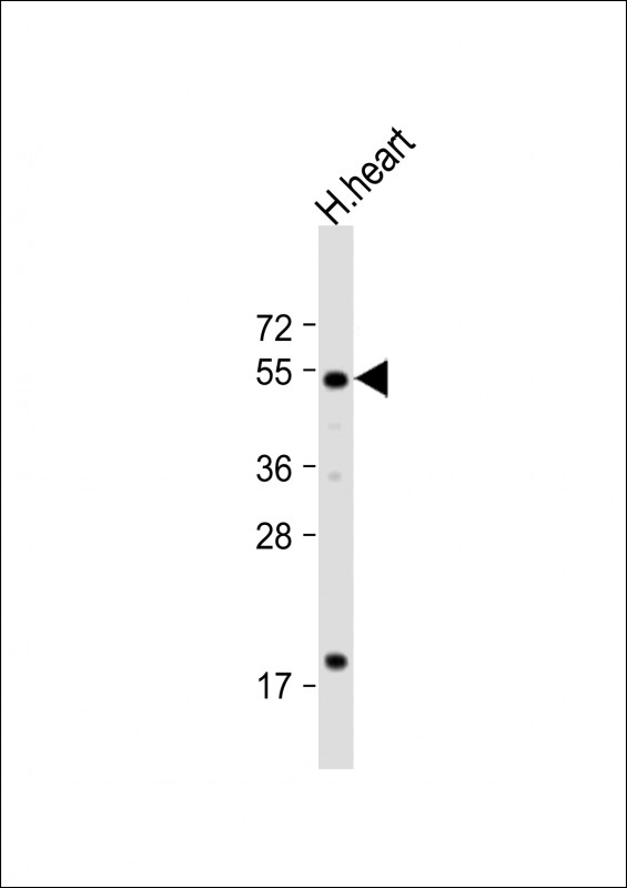 Anti-HtrA3 Antibody (N-term) at 1:1000 dilution + human heart lysateLysates/proteins at 20 �g per lane. SecondaryGoat Anti-Rabbit IgG,  (H+L), Peroxidase conjugated at 1/10000 dilution. Predicted band size : 49 kDaBlocking/Dilution buffer: 5% NFDM/TBST.