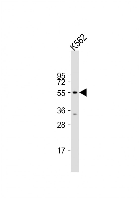 WB - HYAL4 Antibody (Center) AP13683C