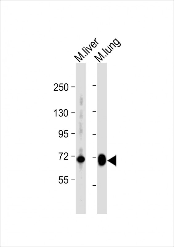 WB - Mouse Hipk4 Antibody (C-term) AP14121B