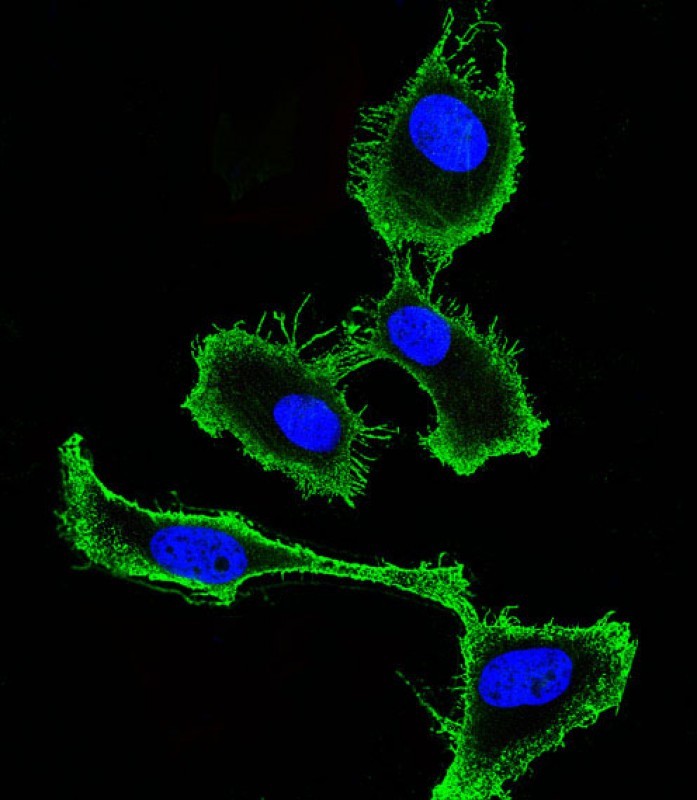 Immunofluorescent analysis of 4% paraformaldehyde-fixed, 0.1% Triton X-100 permeabilized Hela (Human Cervical epithelial adenocarcinoma cell line) cells labeling CD9 with AP1482d at 1/25 dilution, followed by Dylight� 488-conjugated goat anti-rabbit IgG (NK179883) secondary antibody at 1/200 dilution (green). Immunofluorescence image showing membrane staining on Hela cell line. The nuclear counter stain is DAPI (blue).