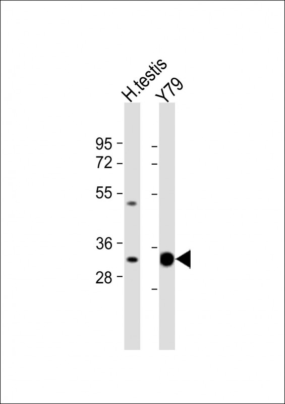 WB - ELOVL4 Antibody (C-term) AP16326b