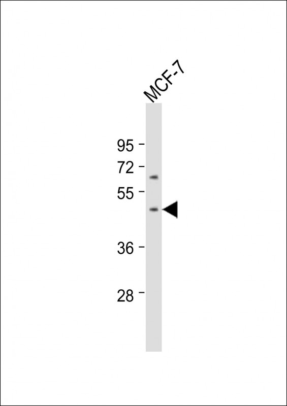 Anti-PAX2 Antibody (Center) at 1:1000 dilution + MCF-7 whole cell lysateLysates/proteins at 20 �g per lane. SecondaryGoat Anti-Rabbit IgG,  (H+L), Peroxidase conjugated at 1/10000 dilution. Predicted band size : 45 kDaBlocking/Dilution buffer: 5% NFDM/TBST.