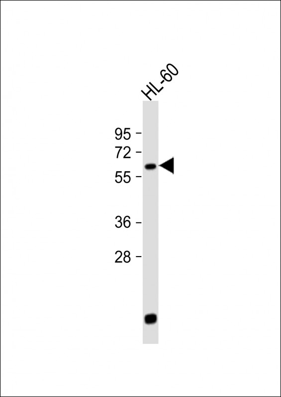 WB - LIN9 Antibody (N-term) AP17067A
