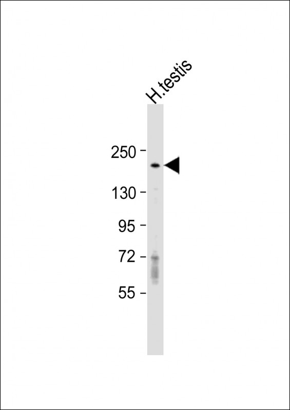 WB - DLEC1 Antibody (Center) AP17986c
