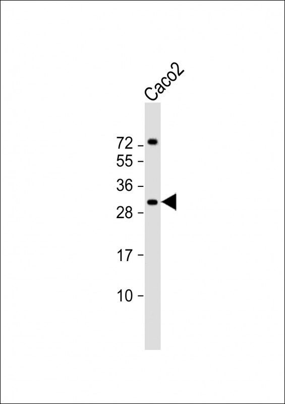 WB - RASL12 Antibody (C-term) AP18108b