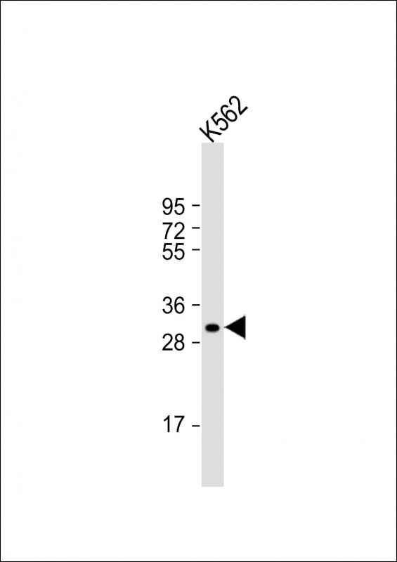 WB - NKX6-2 Antibody (N-term) AP18279a