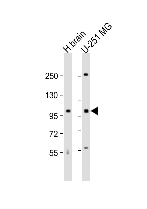 WB - MBD6 Antibody (C-term) AP18913B
