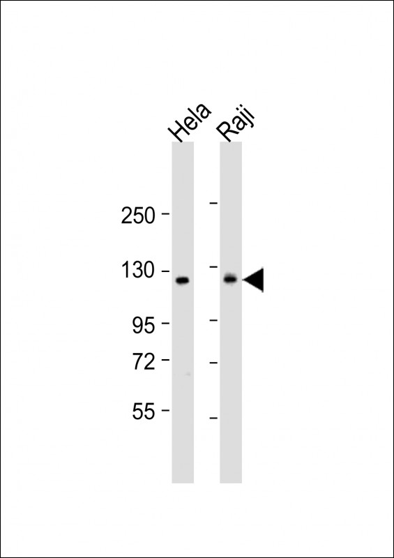 All lanes : Anti-NFKB(p100) Antibody (C-term S866/870) at 1:1000 dilutionLane 1: Hela whole cell lysateLane 2: Raji whole cell lysateLysates/proteins at 20 �g per lane. SecondaryGoat Anti-Rabbit IgG,  (H+L), Peroxidase conjugated at 1/10000 dilution. Predicted band size : 97 kDaBlocking/Dilution buffer: 5% NFDM/TBST.