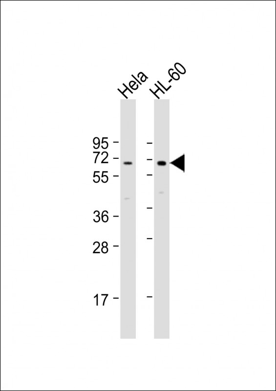 WB - PIGB Antibody (N-term) AP20135a