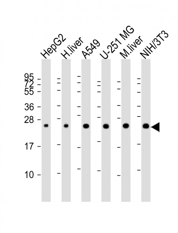 All lanes : Anti-BLVRB Antibody (C-term) at 1:2000 dilutionLane 1: HepG2 whole cell lysateLane 2: human liver lysateLane 3: A549 whole cell lysateLane 4: U-251 MG whole cell lysateLane 5: mouse liver lysateLane 6: NIH/3T3 whole cell lysateLysates/proteins at 20 �g per lane. SecondaryGoat Anti-Rabbit IgG,  (H+L), Peroxidase conjugated at 1/10000 dilution. Predicted band size : 22 kDaBlocking/Dilution buffer: 5% NFDM/TBST.