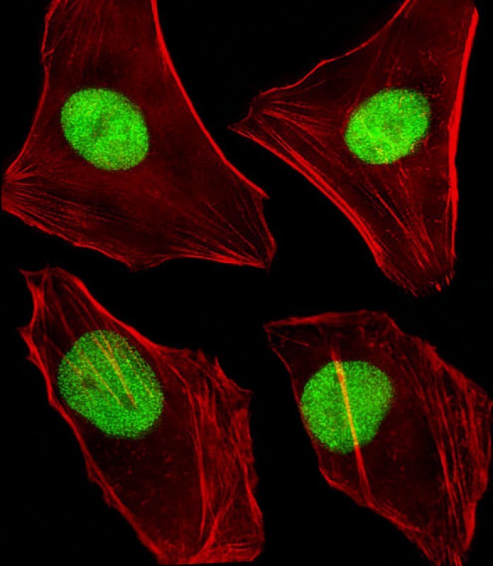 Immunofluorescent analysis of 4% paraformaldehyde-fixed, 0.1% Triton X-100 permeabilized HeLa (human cervical epithelial adenocarcinoma cell line) cells labeling Dnmt1 with AP21131a at 1/50 dilution, followed by Dylight� 488-conjugated goat anti-rabbit IgG (NK179883) secondary antibody at 1/200 dilution (green). Immunofluorescence image showing nucleus staining on HeLa cell line. Cytoplasmic actin is detected with Dylight� 554 Phalloidin (PD18466410) at 1/100 dilution (red).