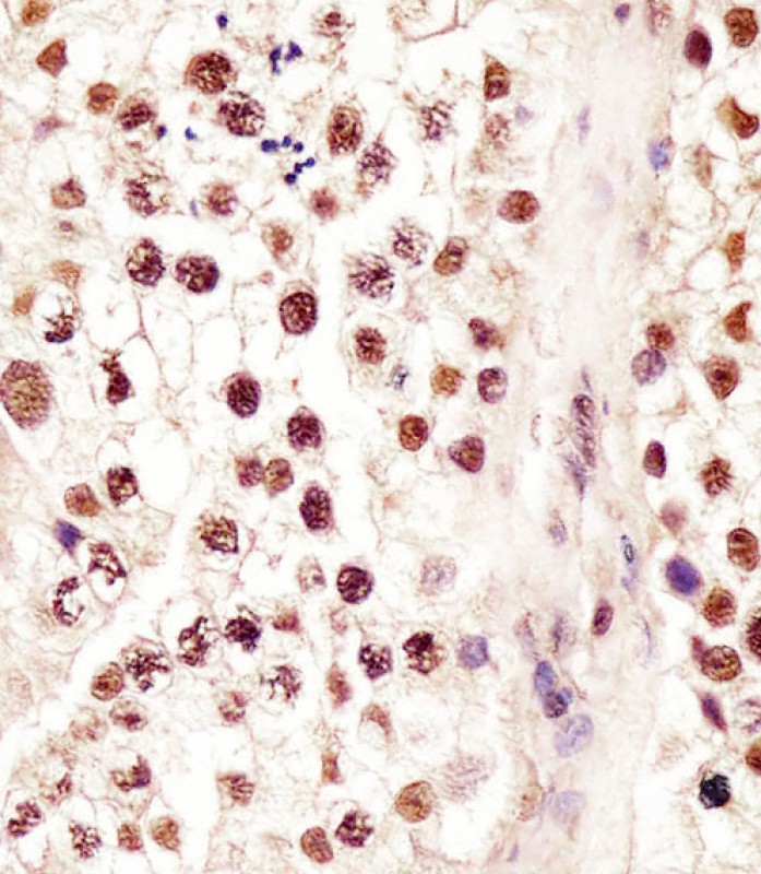 IHC-P - RBMX Antibody (Center) AP21511c