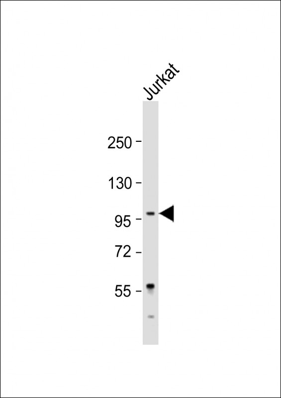 Anti-LARGE Antibody (Center) at 1:2000 dilution + Jurkat whole cell lysateLysates/proteins at 20 �g per lane. SecondaryGoat Anti-Rabbit IgG,  (H+L), Peroxidase conjugated at 1/10000 dilution. Predicted band size : 88 kDaBlocking/Dilution buffer: 5% NFDM/TBST.