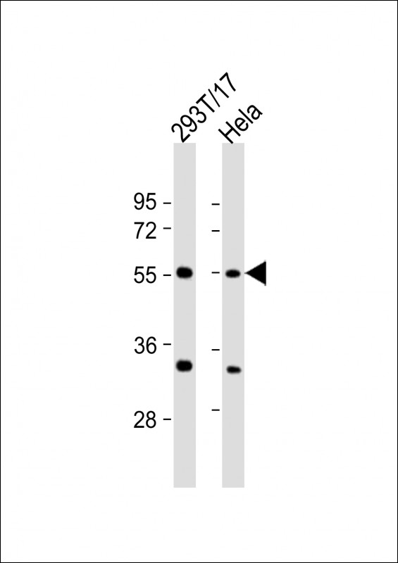All lanes : Anti-AAAS Antibody (C-Term) at 1:2000 dilutionLane 1: 293T/17 whole cell lysateLane 2: Hela whole cell lysateLysates/proteins at 20 �g per lane. SecondaryGoat Anti-Rabbit IgG,  (H+L), Peroxidase conjugated at 1/10000 dilution. Predicted band size : 60 kDaBlocking/Dilution buffer: 5% NFDM/TBST.
