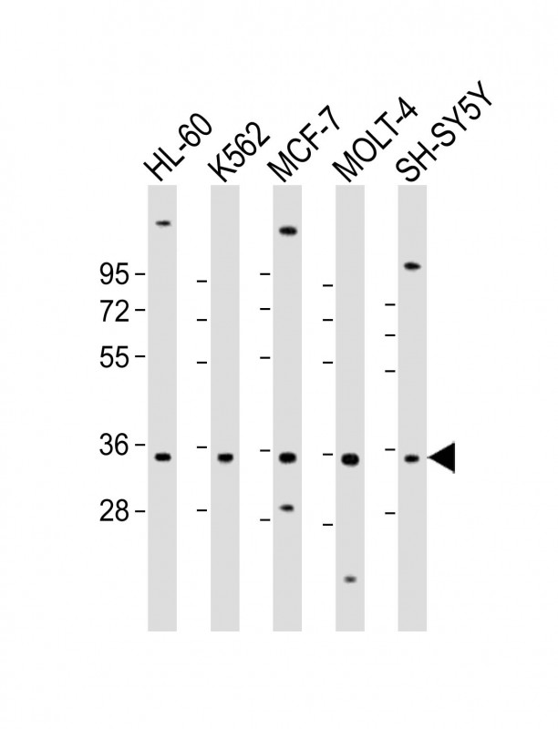 All lanes : Anti-PIGC Antibody (Center) at 1:2000 dilutionLane 1: HL-60 whole cell lysateLane 2: K562 whole cell lysateLane 3: MCF-7 whole cell lysateLane 4: MOLT-4 whole cell lysateLane 5: SH-SY5Y whole cell lysateLysates/proteins at 20 �g per lane. SecondaryGoat Anti-Rabbit IgG,  (H+L), Peroxidase conjugated at 1/10000 dilution. Predicted band size : 34 kDaBlocking/Dilution buffer: 5% NFDM/TBST.