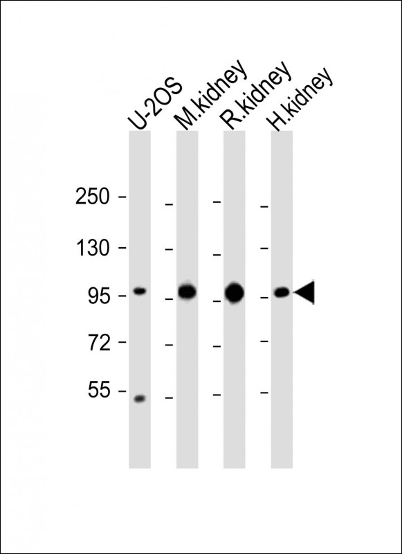 All lanes : Anti-ACO1 Antibody (N-Term) at 1:2000 dilutionLane 1: U-2OS whole cell lysateLane 2: mouse kidney lysateLane 3: rat kidney lysateLane 4: human kidney lysateLysates/proteins at 20 �g per lane. SecondaryGoat Anti-Rabbit IgG,  (H+L), Peroxidase conjugated at 1/10000 dilution. Predicted band size : 98 kDaBlocking/Dilution buffer: 5% NFDM/TBST.