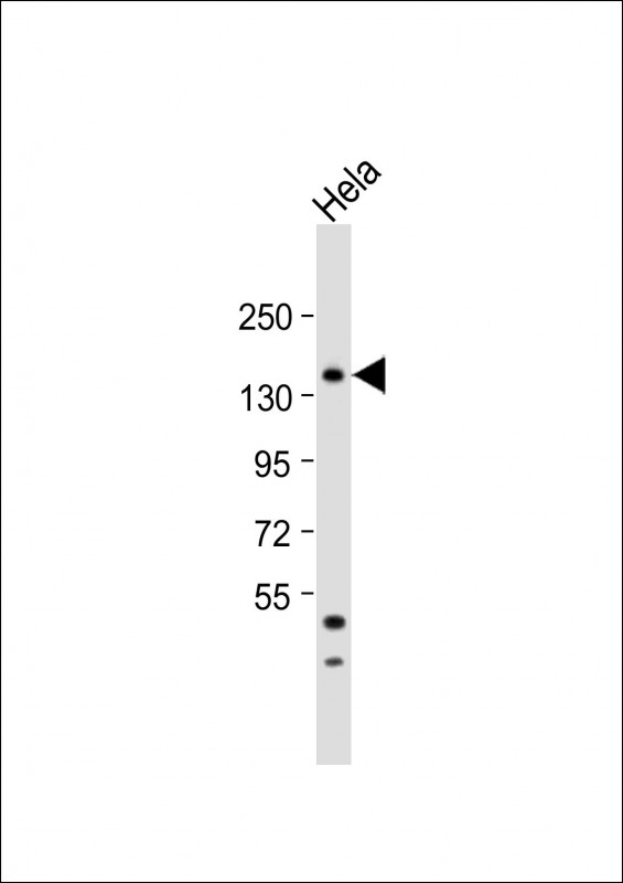 WB - MTMR15 Antibody  (N-term) AP5247a