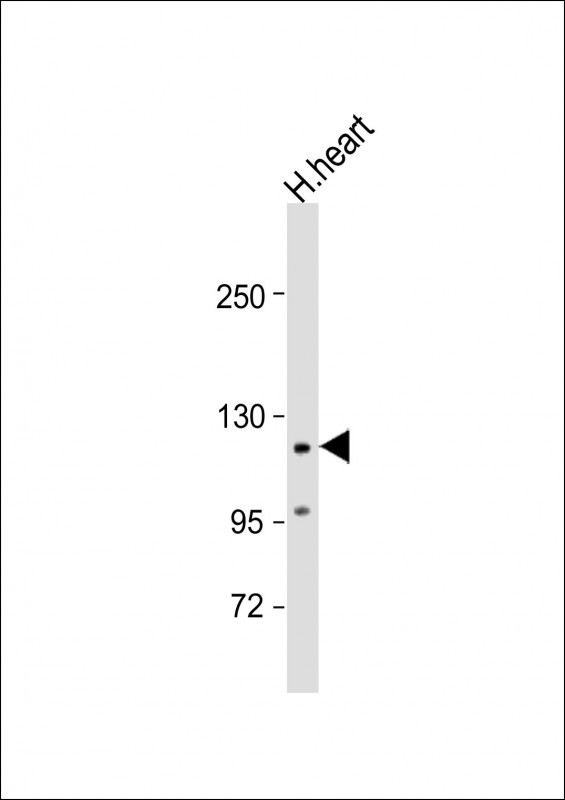 Anti-VLDLR Antibody (Center) at 1:2000 dilution + human heart lysateLysates/proteins at 20 �g per lane. SecondaryGoat Anti-Rabbit IgG,  (H+L), Peroxidase conjugated at 1/10000 dilution. Predicted band size : 96 kDaBlocking/Dilution buffer: 5% NFDM/TBST.