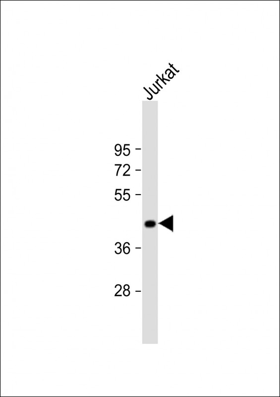 WB - ST3GAL5 Antibody (C-term) AP5834b