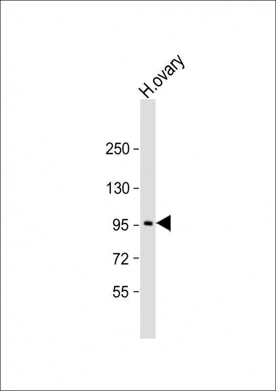 Anti-LRP3 Antibody (C-term) at 1:2000 dilution + human ovary lysateLysates/proteins at 20 �g per lane. SecondaryGoat Anti-Rabbit IgG,  (H+L), Peroxidase conjugated at 1/10000 dilution. Predicted band size :83 kDaBlocking/Dilution buffer: 5% NFDM/TBST.