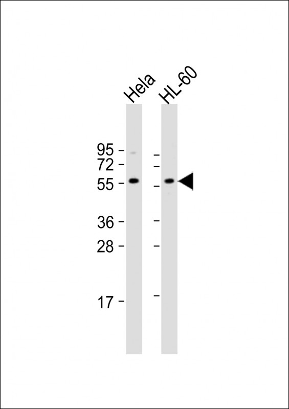 WB - Presenilin 1 Antibody (C-term) [Knockout Validated] AW5708-U100