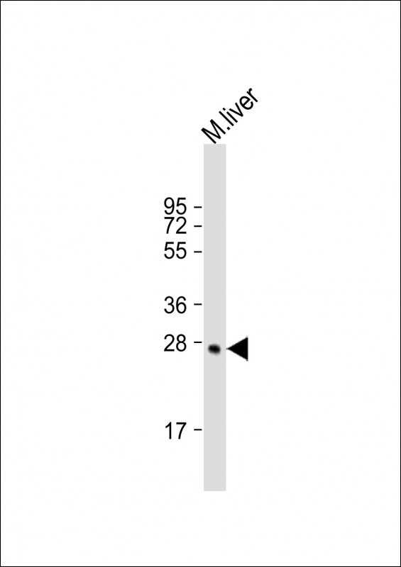 Anti-Mouse Sirt3 Antibody (C-term) at 1:2000 dilution + mouse liver lysateLysates/proteins at 20 �g per lane. SecondaryGoat Anti-Rabbit IgG,  (H+L), Peroxidase conjugated at 1/10000 dilution. Predicted band size : 37 kDaBlocking/Dilution buffer: 5% NFDM/TBST.