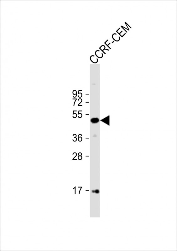 Anti-MYCN Antibody (C-term) at 1:1000 dilution + CCRF-CEM whole cell lysateLysates/proteins at 20 �g per lane. SecondaryGoat Anti-Rabbit IgG,  (H+L), Peroxidase conjugated at 1/10000 dilution. Predicted band size : 50 kDaBlocking/Dilution buffer: 5% NFDM/TBST.