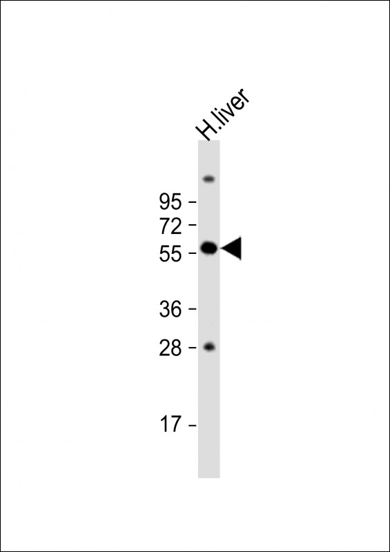 Anti-SLC11A1 Antibody (Center) at 1:1000 dilution + human liver lysateLysates/proteins at 20 �g per lane. SecondaryGoat Anti-Rabbit IgG,  (H+L), Peroxidase conjugated at 1/10000 dilution. Predicted band size : 60 kDaBlocking/Dilution buffer: 5% NFDM/TBST.