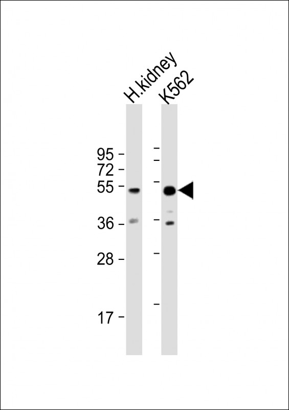 All lanes : Anti-ALDH3B1 Antibody (Center) at 1:1000 dilutionLane 1: human kidney lysateLane 2: K562 whole cell lysateLysates/proteins at 20 �g per lane. SecondaryGoat Anti-Rabbit IgG,  (H+L), Peroxidase conjugated at 1/10000 dilution. Predicted band size : 52 kDaBlocking/Dilution buffer: 5% NFDM/TBST.