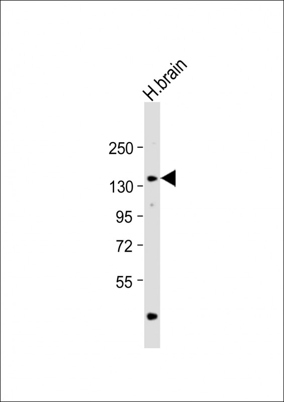 Anti-ADCY8 Antibody (Center) at 1:1000 dilution + human brain lysateLysates/proteins at 20 �g per lane. SecondaryGoat Anti-Rabbit IgG,  (H+L), Peroxidase conjugated at 1/10000 dilution. Predicted band size : 140 kDaBlocking/Dilution buffer: 5% NFDM/TBST.