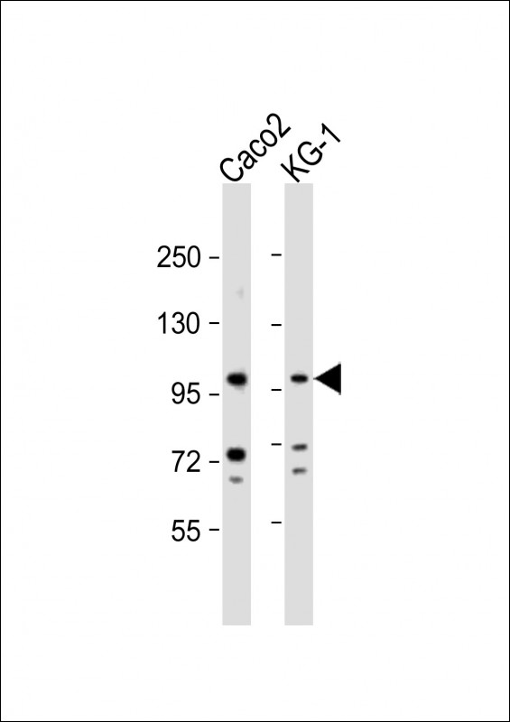 All lanes : Anti-CSF3R Antibody (Center) at 1:1000 dilutionLane 1: Caco2 whole cell lysateLane 2: KG-1 whole cell lysateLysates/proteins at 20 �g per lane. SecondaryGoat Anti-Rabbit IgG,  (H+L), Peroxidase conjugated at 1/10000 dilution. Predicted band size : 92 kDaBlocking/Dilution buffer: 5% NFDM/TBST.