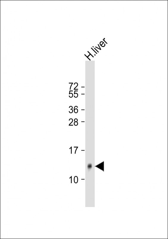 Anti-HAMP Antibody (Center) at 1:500 dilution + human liver lysateLysates/proteins at 20 �g per lane. SecondaryGoat Anti-Rabbit IgG,  (H+L), Peroxidase conjugated at 1/10000 dilution. Predicted band size : 9 kDaBlocking/Dilution buffer: 5% NFDM/TBST.