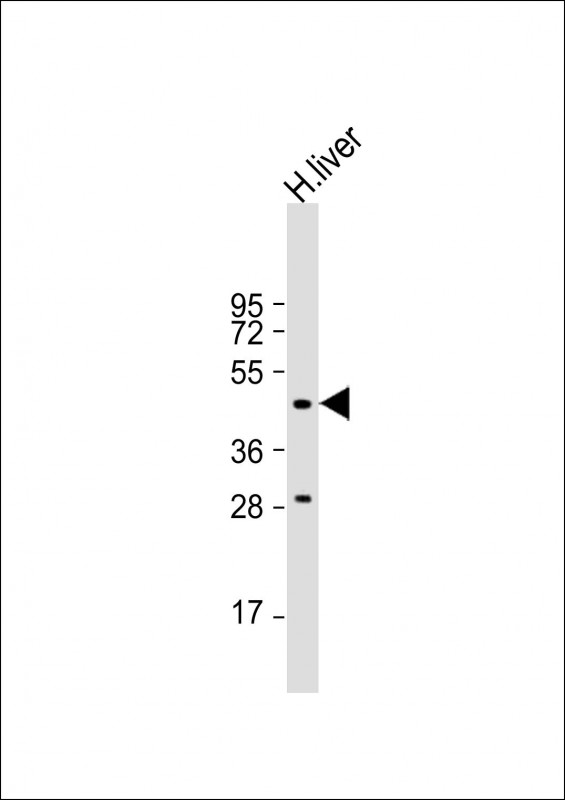 WB - MMAA Antibody (N-term) AP9795a