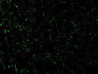 IF - CIDE-A Antibody ASC10052