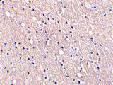 IHC - CIDE-A Antibody ASC10052