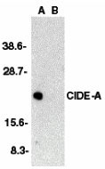 WB - CIDE-A Antibody ASC10052