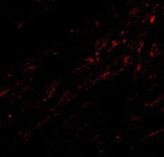 IF - CIDE-A Antibody ASC10053