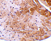 IHC - CIDE-A Antibody ASC10053