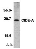 WB - CIDE-A Antibody ASC10053