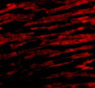 IF - Bcl-rambo Antibody ASC10167