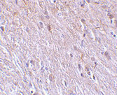IHC - TTC5 Antibody ASC10179