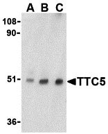 WB - TTC5 Antibody ASC10179