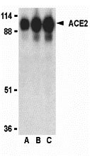 WB - ACE2 Antibody ASC10216