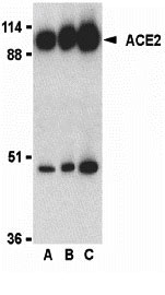 WB - ACE2 Antibody ASC10217