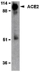 WB - ACE2 Antibody ASC10223