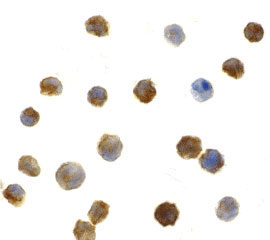 ICC - IRAK2 Antibody ASC10350